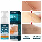 Jaysuing Advanced Scar Gel50 gram - Image 2
